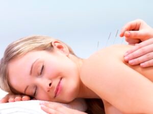 Guide for Choosing an Acupuncturist