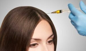 How Effective is Stem Cell Therapy for Hair Loss?
