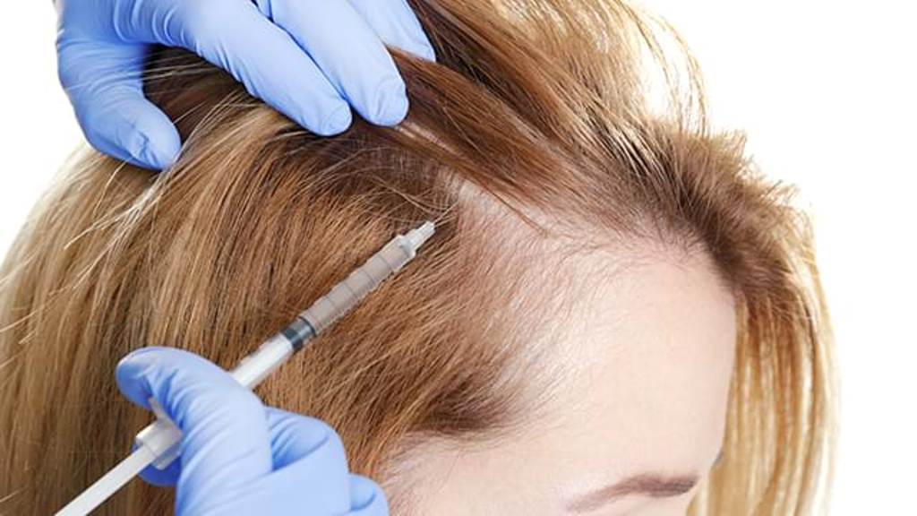 stem cell treatment for hair loss