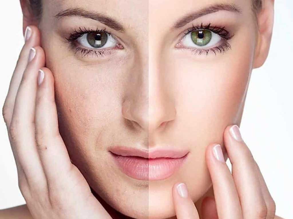 Skin Rejuvenation The Essence Of It All