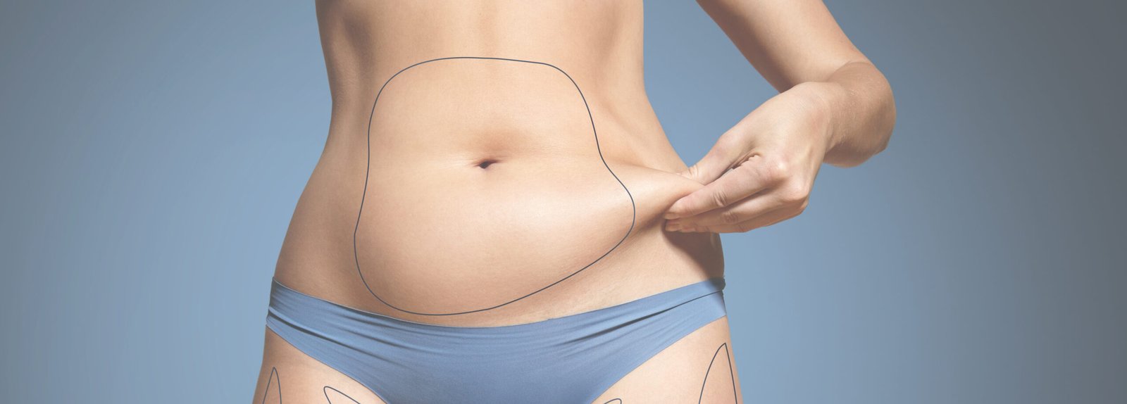 coolsculpting handles liposuction difference muffin between bruising