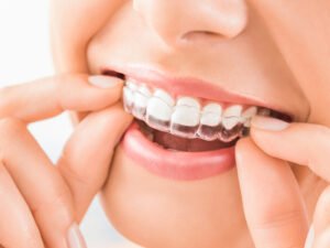 Invisalign Singapore: Aftercare Guidelines by Certified Dental Surgeons