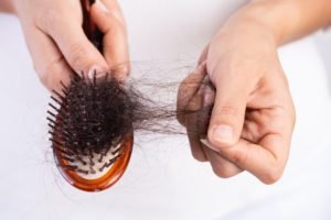 Iron Deficiency and Hair Loss: How To Deal With It?
