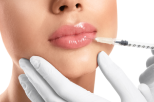 Plump It Up with Lip Fillers