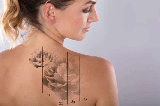 The Best Tattoo Numbing Cream: How It Works and How to Use It for a Painless Tattoo Experience